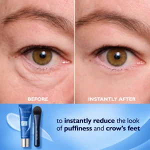 Eye Tightener Easy - Image 3