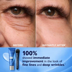 Eye Tightener Easy - Image 4