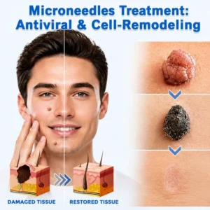 Microneedle Clear Patches - Image 2