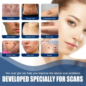 NESLEMY Scar Removel Gel Smoothing Skin Hydrate & Moisturize - Image 7