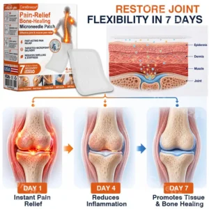 Pain-Relief Bone-Healing Microneedle Patch - Image 8