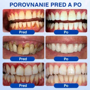 GumRevive Parodontálny opravný gél - Image 4