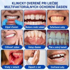 GumRevive Parodontálny opravný gél - Image 6