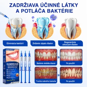 GumRevive Parodontálny opravný gél - Image 9