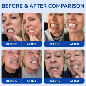 Periodontal Repair Gel - Image 2