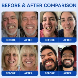 Periodontal Repair Gel - Image 3
