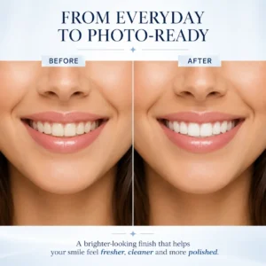 LOVILDS Tooth Polish - Instant White Smile - Image 5