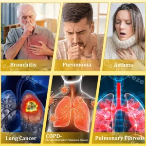 6-in-1 Herbal BeePropolis Lung Cleanse Spray - Image 5