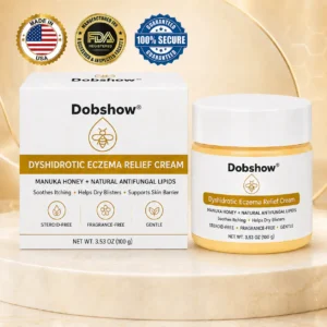Dry Itchy & Blister-Prone Hand Relief Cream