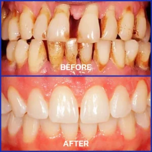 VioCore Bee Venom Dental Treatment Toothpaste - Image 3