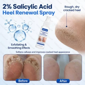 2% Salicylic Acid Callus & Cracked Heel Spray - Image 5