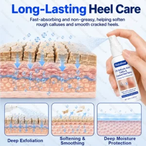 2% Salicylic Acid Callus & Cracked Heel Spray - Image 6
