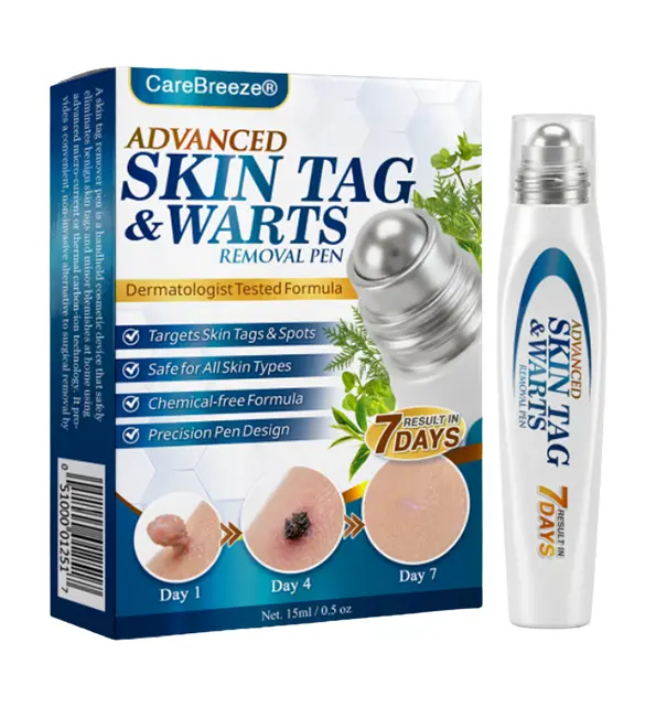 Advanced Skin Tag & Wart Removal Roller - Image 7