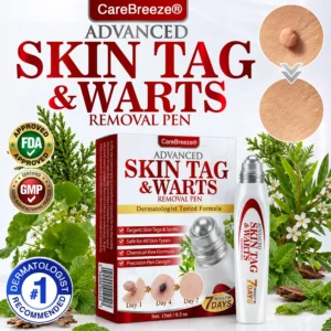 Herbal Skin Tag & Wart Removal Roller
