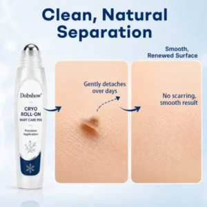 7 -Day Wart & Blemish Remover - Image 8
