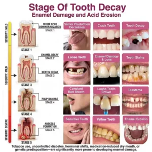 DenPerm Cavity-Repair Advanced Enamel Filling Gel - Image 6