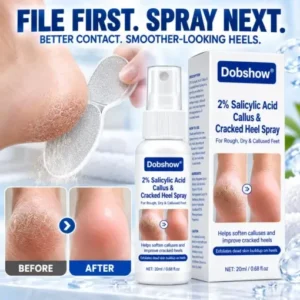 Medical-Grade 2% Salicylic Acid Callus & Cracked Heel Repair Spray - Image 3
