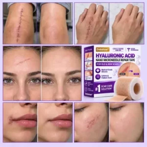 Medical-Grade Nano Microneedle Scar Repair Tape - Image 3