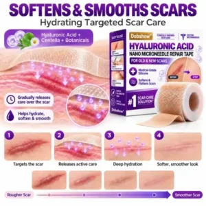 Medical-Grade Nano Microneedle Scar Repair Tape - Image 6