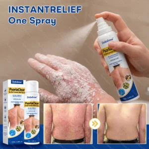 PsoriaClear No-Rub Psoriasis Relief Spray - Image 2