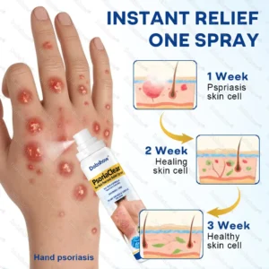 PsoriaClear No-Rub Psoriasis Relief Spray - Image 5