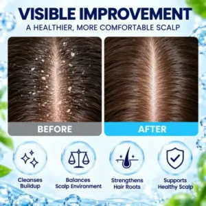 LOVILDS Scalp Soothing Cream - Image 3
