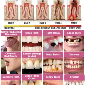DenPerm Cavity-Repair Natural Enamel Filling Gel - Image 2