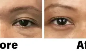 Nano Vision Repair Eye Serum - Image 12