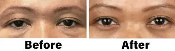 Nano Vision Repair Eye Serum - Image 12