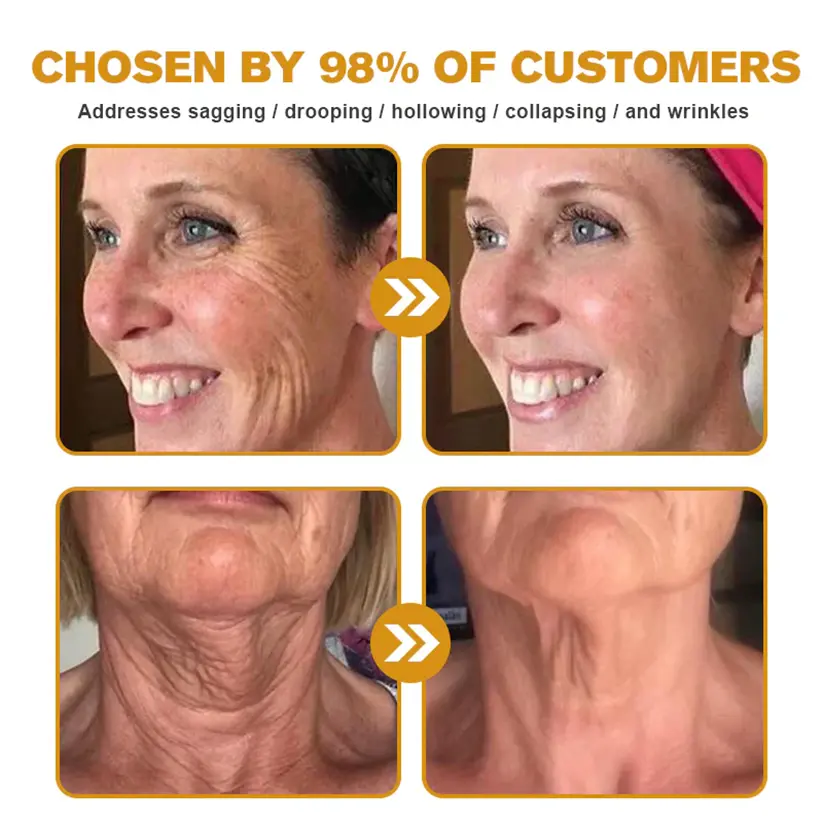 Bee venom Pro Comprehensive Cream—Tightening for Skin Types - Image 3