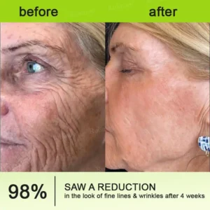 Botox & Vita-A Retinol Shot Wrinkle-Lift Tightening cream - Image 12