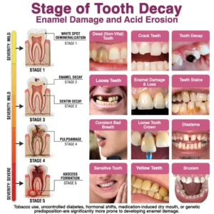DenPerm Cavity-Repair Natural Enamel - Image 6