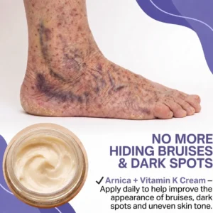 Newly Upgraded Dark Spot & Bruise Recovery Cream - Image 5