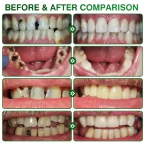 CavityReverse Pept11 MicroFill Gel - Image 3