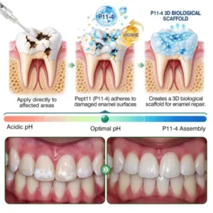 CavityReverse Pept11 MicroFill Gel - Image 6