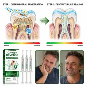 CavityReverse Pept11 MicroFill Gel - Image 8