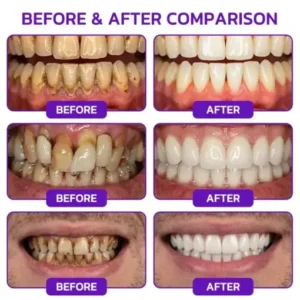 VioGum Gingivitis & Periodontal Rescue Gel - Image 3