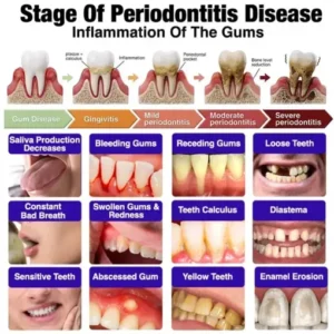 VioGum Gingivitis & Periodontal Rescue Gel - Image 5