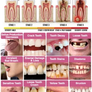 DenPerm – Natural Enamel Repair & Cavity Filling Gel - Image 9
