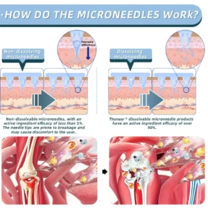 Nano-microneedle joint patch - Image 5