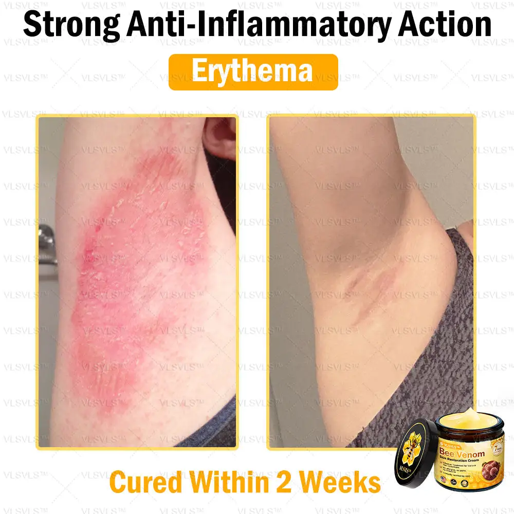Bee Venom Skin Restoration Cream - Image 12