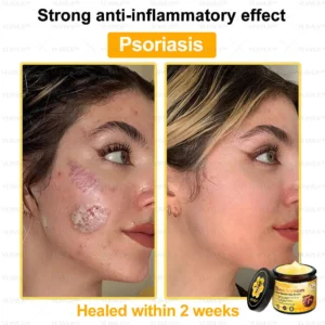 Bee Venom Skin Restoration Cream - Image 3