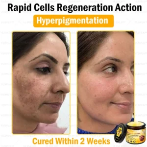 Bee Venom Skin Restoration Cream - Image 8
