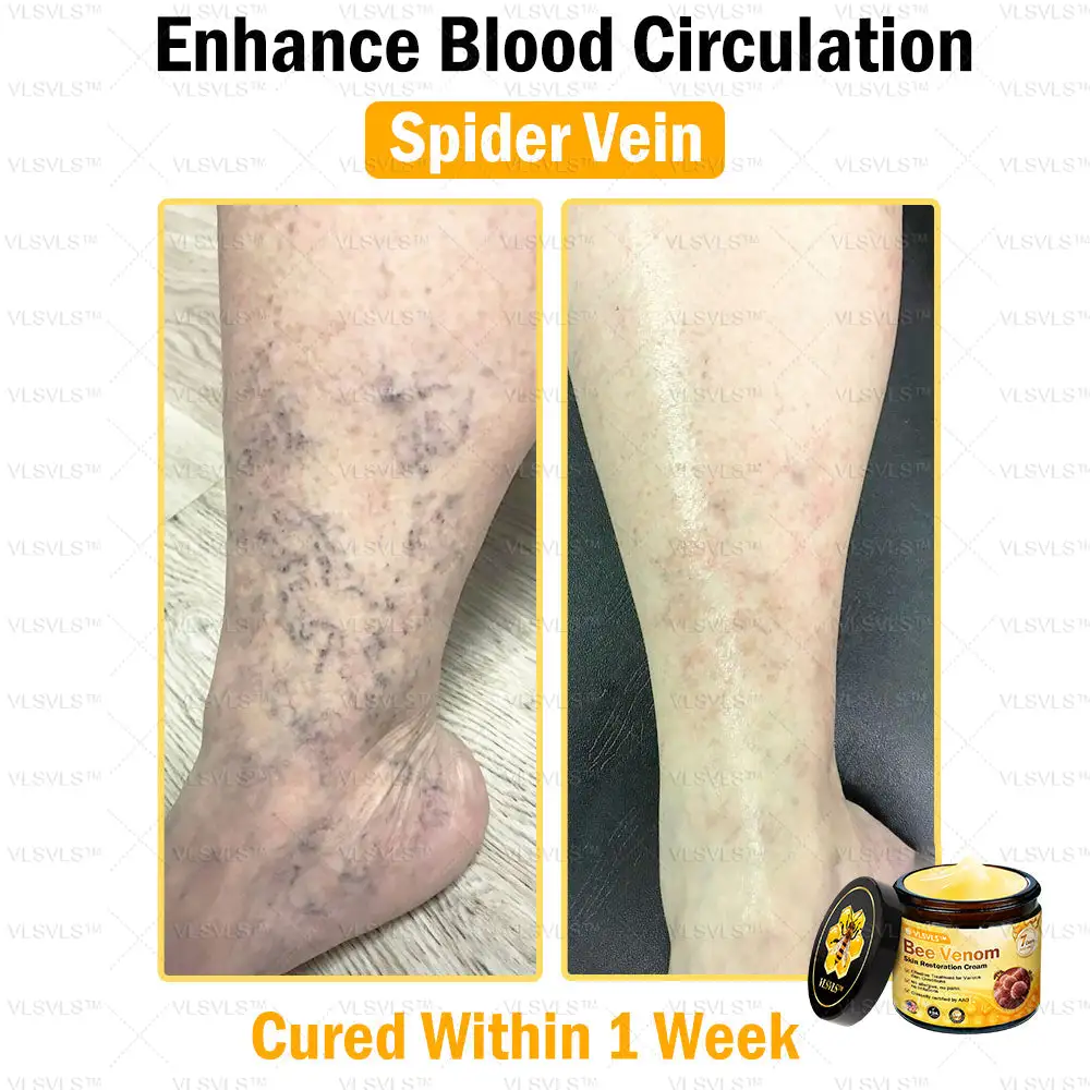 Bee Venom Skin Restoration Cream - Image 9